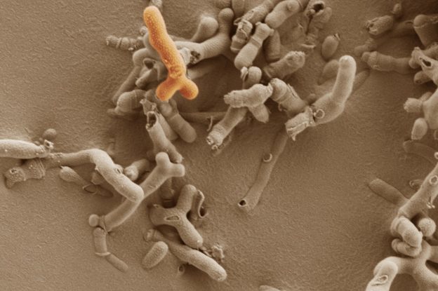 主要的婴儿微生物群成员双歧杆菌